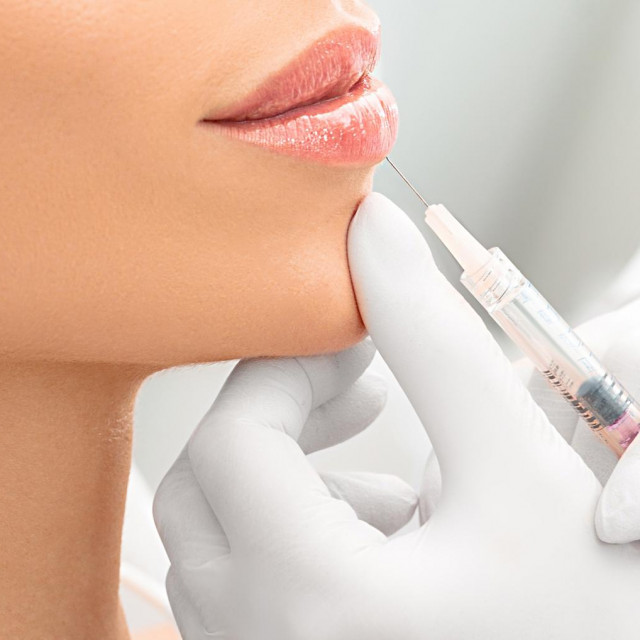 Vijek filera za usnice obično je od šest do dvanaest mjeseci