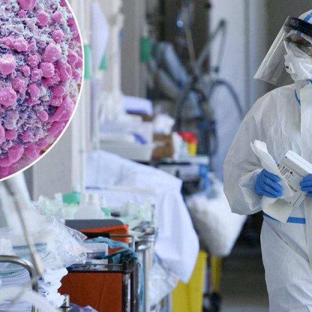 Ilustracija delta soja koronavirusa i prizor iz Klinike Fran Mihaljević
