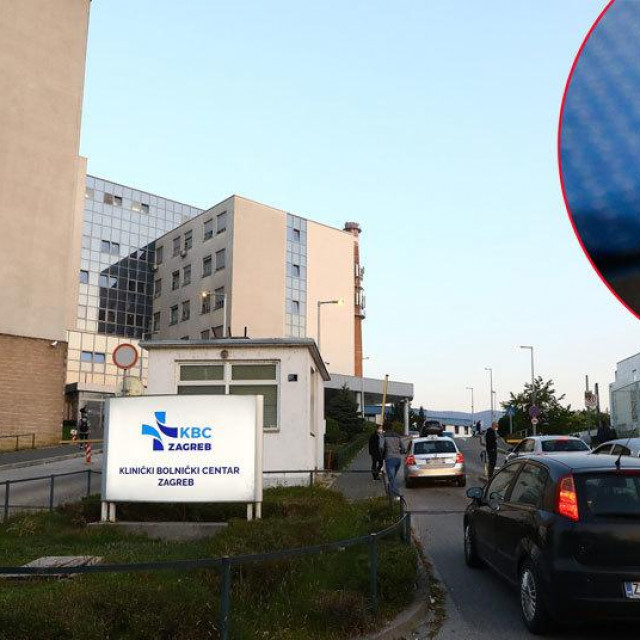 KBC Zagreb
