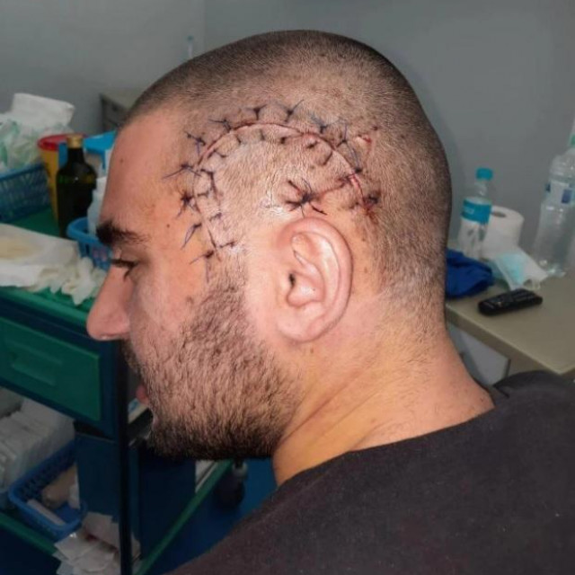 Ozlijeđeni Duje Hrgović Štefanić
