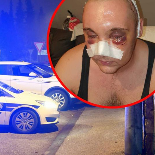 Pretučeni Vinkovčanin
