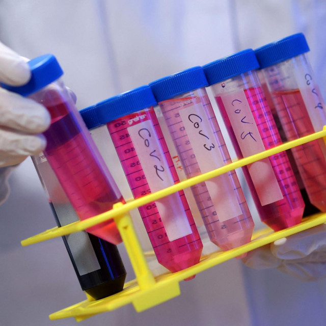 Epruvete sa stanicama covid-19 virusa
