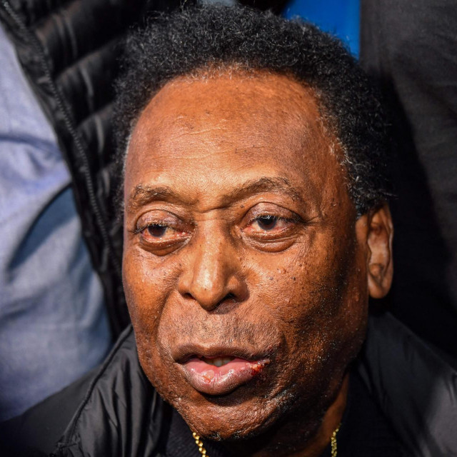 Pele
