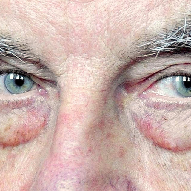 Josef Fritzl
