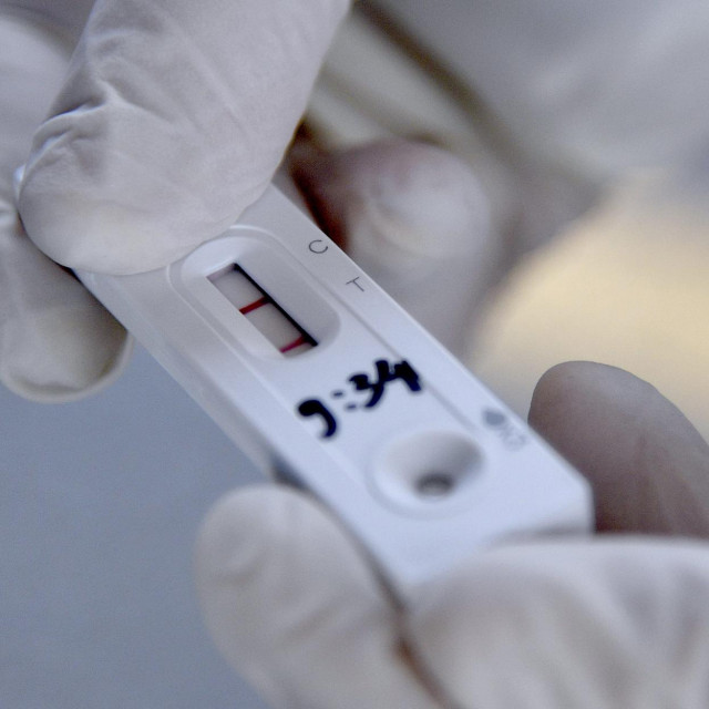 Brzi antigenski test/Ilustracija
