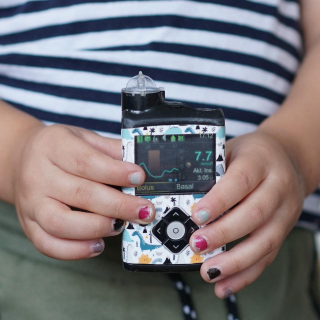 Inzulinska pumpa/Ilustracija
