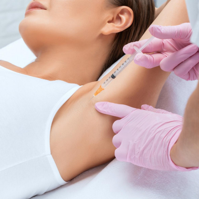 The doctor makes injections of botulinum toxin in the underarm area against hyperhidrosis. Women's cosmetology concept.