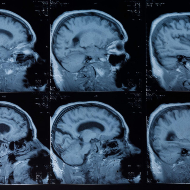 Ilustrativna fotografija
