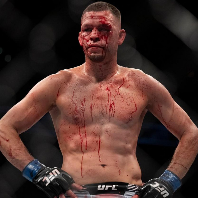 Nate DIaz
