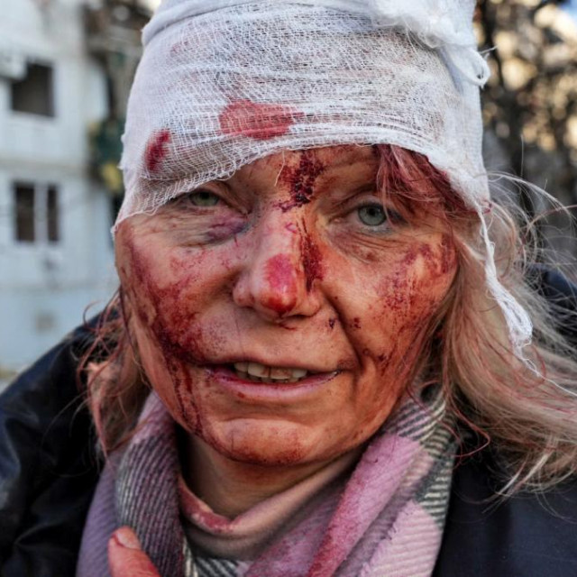 Ozlijeđena Olena Kurilo
