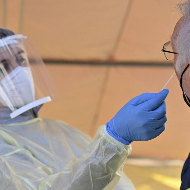 Brzi antigenski test