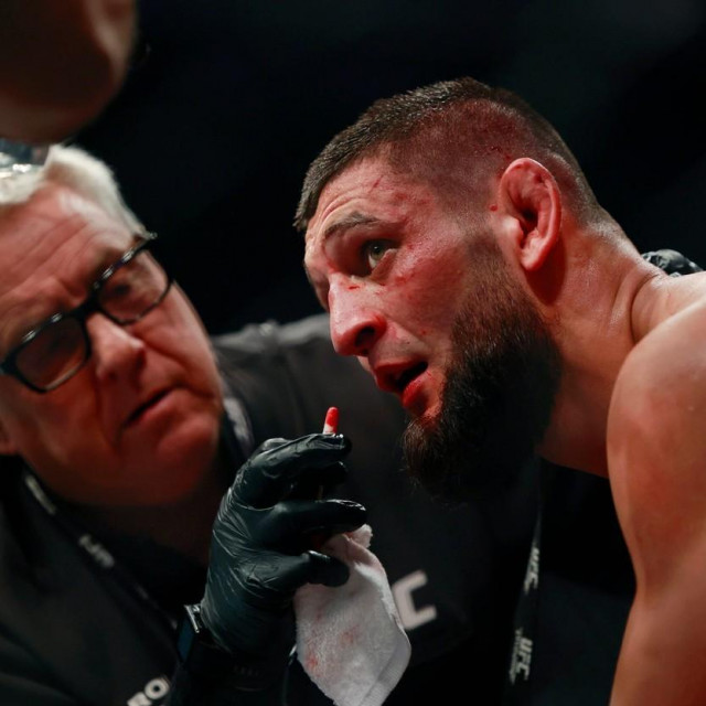 Khamzat Chimaev looks on from his corner during a welterweight bout against Gilbert Burns Saturday, April 9, 2022 during UFC 273 at VyStar Veterans Memorial Arena in Jacksonville. Chimaev won by unanimous decision. [Corey Perrine/Florida Times-Union]

Jki 041022 Ufc273 38,Image: 682339571, License: Rights-managed, Restrictions: *** World Rights ***, Model Release: no, Credit line: USA TODAY Network/ddp USA/Profimedia