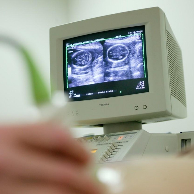 Ilustracija, ultrazvuk tijekom trudnoće