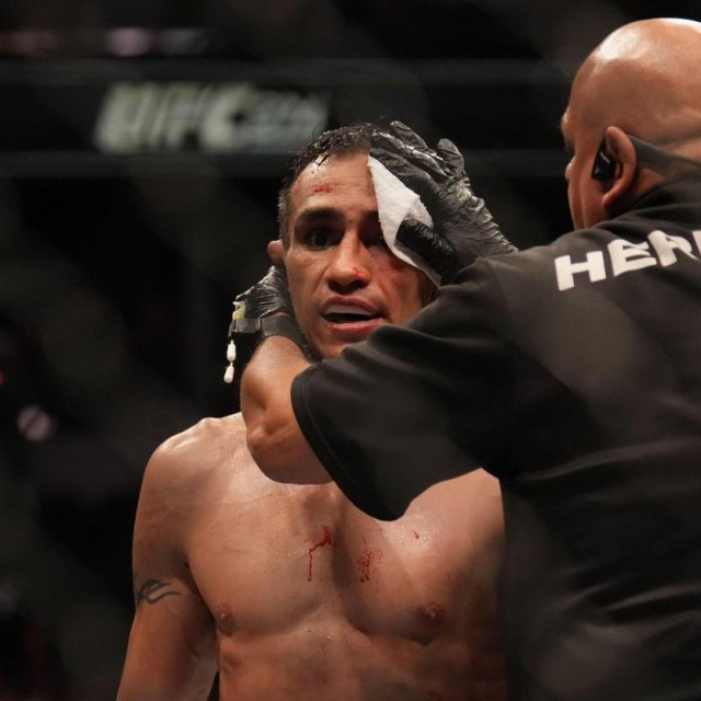 Tony Ferguson