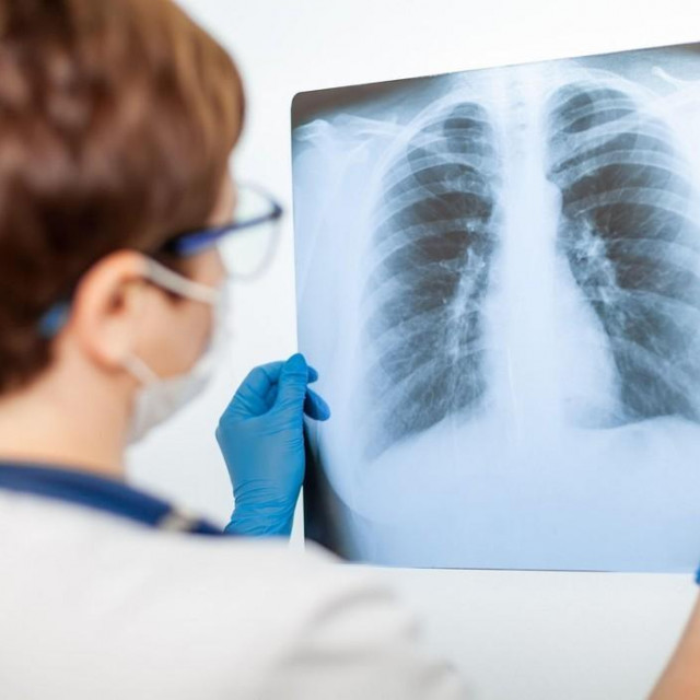 ilustrativna fotografija