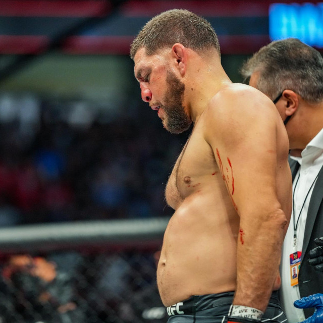 Nick Diaz