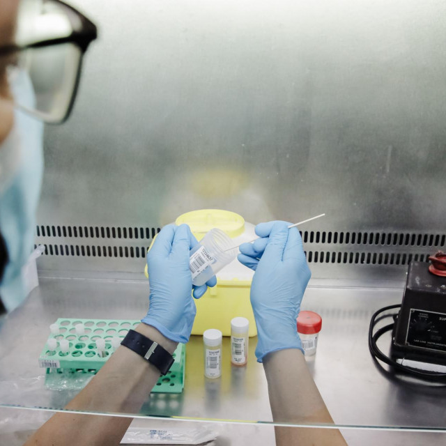 Majmunske boginje smatraju se manje zaraznom bolešću u usporedbi s velikim boginjama, koje su iskorijenjene od 1980.