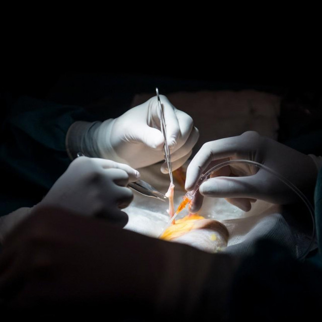 Transplantacija, Ilustrativna fotografija