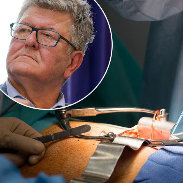 Ante Ćorušić i ilustracija transplantacije buberga