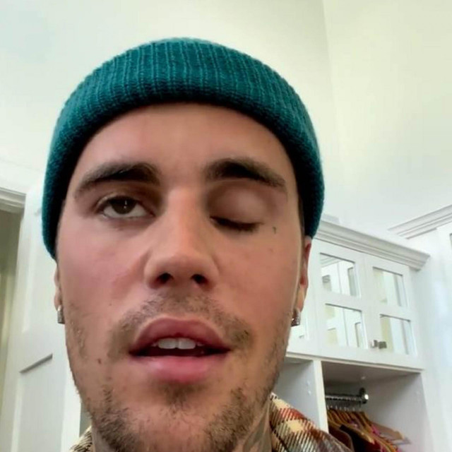 Justin Bieber na instagramu je otkrio kako boluje od Ramsay Hunt sindroma