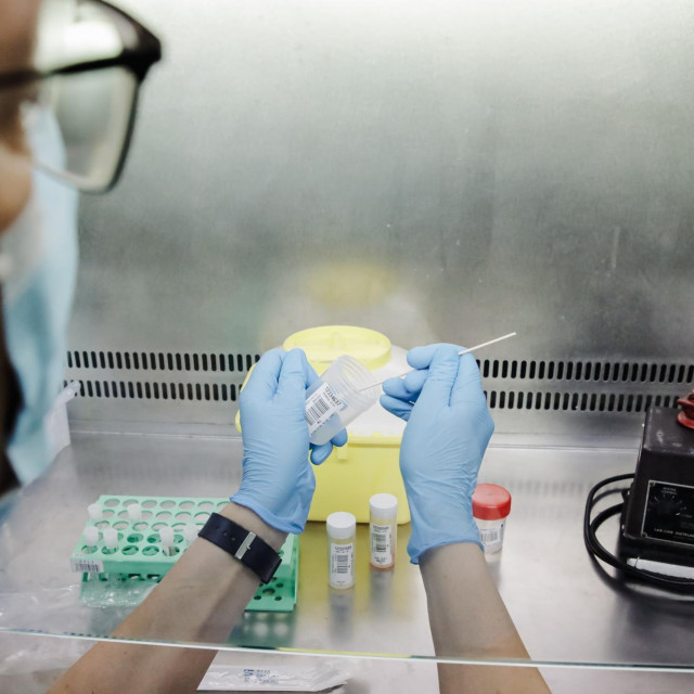 Lezije povezane sa sadašnjom epidemijom također su manje od onih tipičnih za klasične majmunske boginje