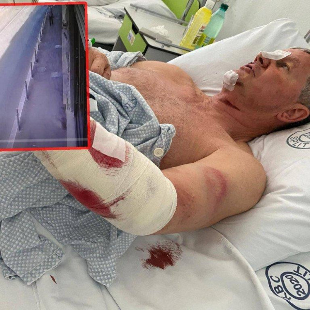 Snimka nepoznatog motoriste; Ozlijeđeni Vedran Jelić u bolničkoj sobi