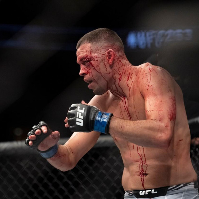 Nate Diaz
