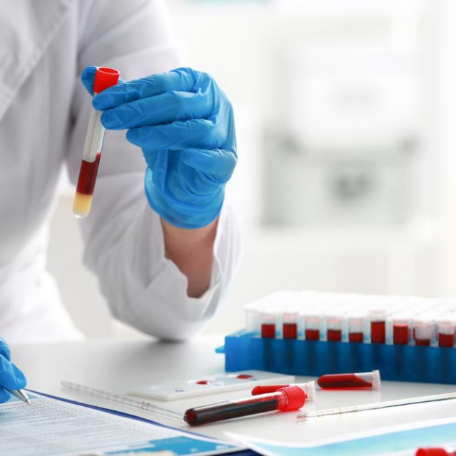 Woman working with blood sample in laboratory