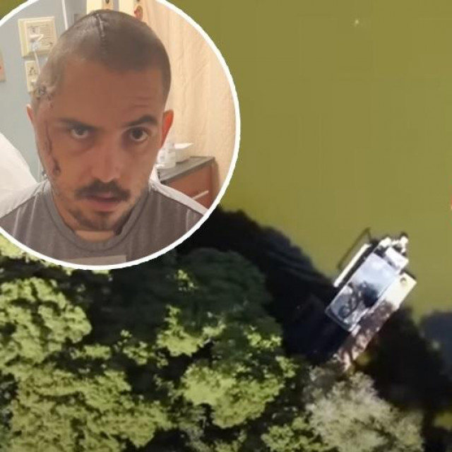 U krugu: J. C. La Verde nakon napada