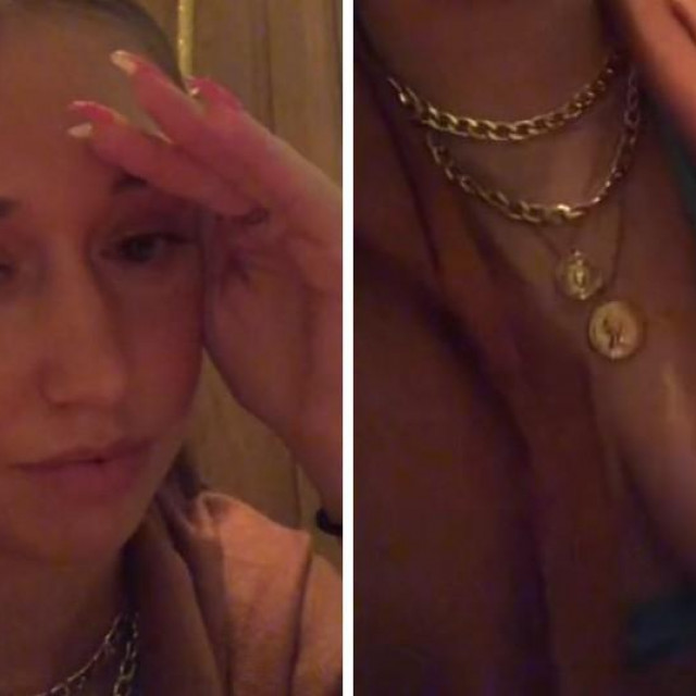 Djevojka dobila šal u otmjenom restoranu da prekrije grudi