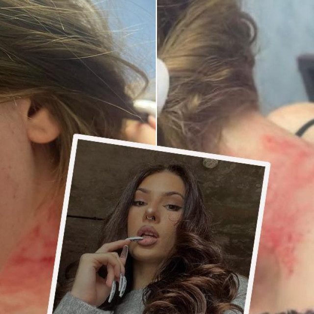 Uki Q i njezina pretučena sestra