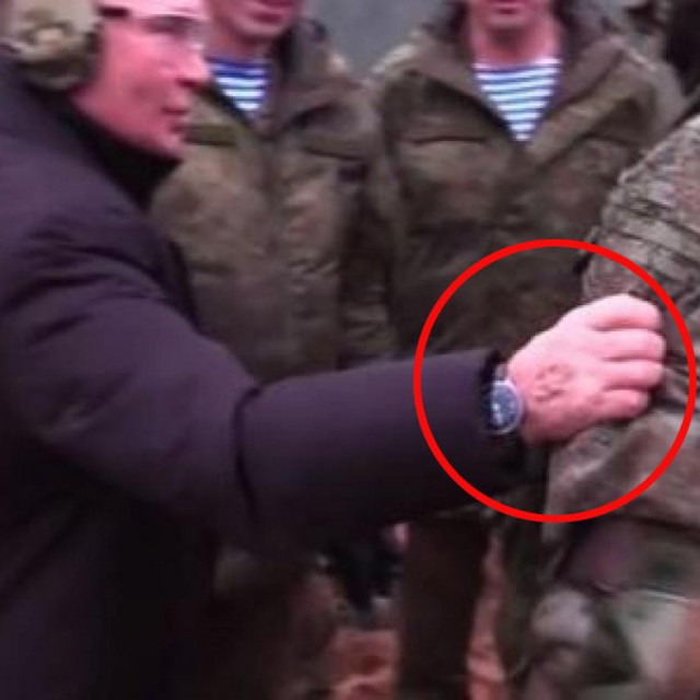Putinova ruka