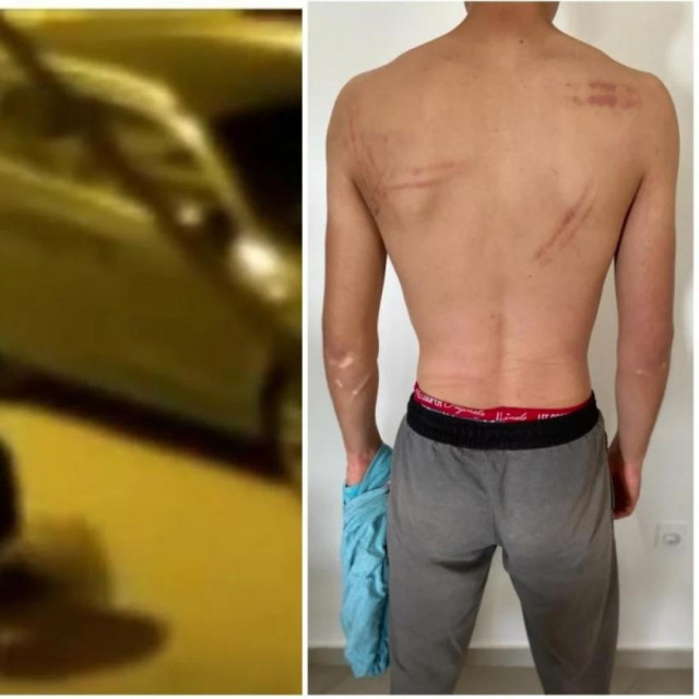 Pretučeni mladić u Splitu