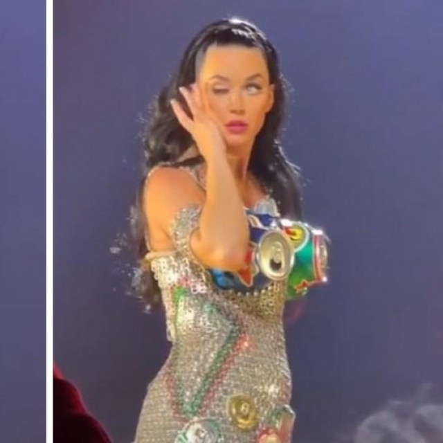Katy Perry zabrinula fanove zbog svog oka