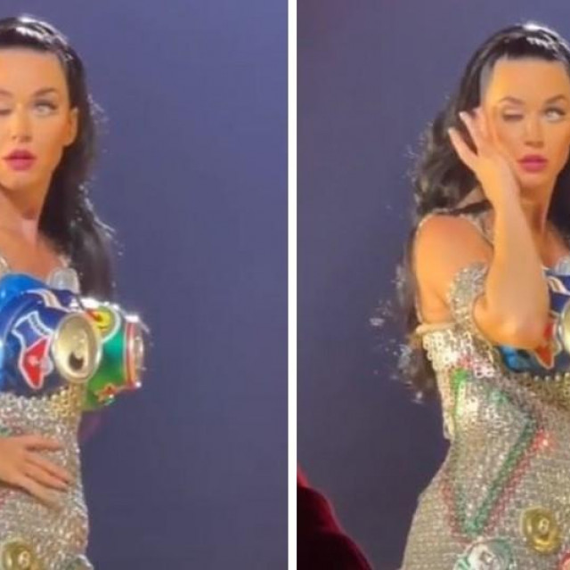 Katy Perry zabrinula fanove zbog svog oka
