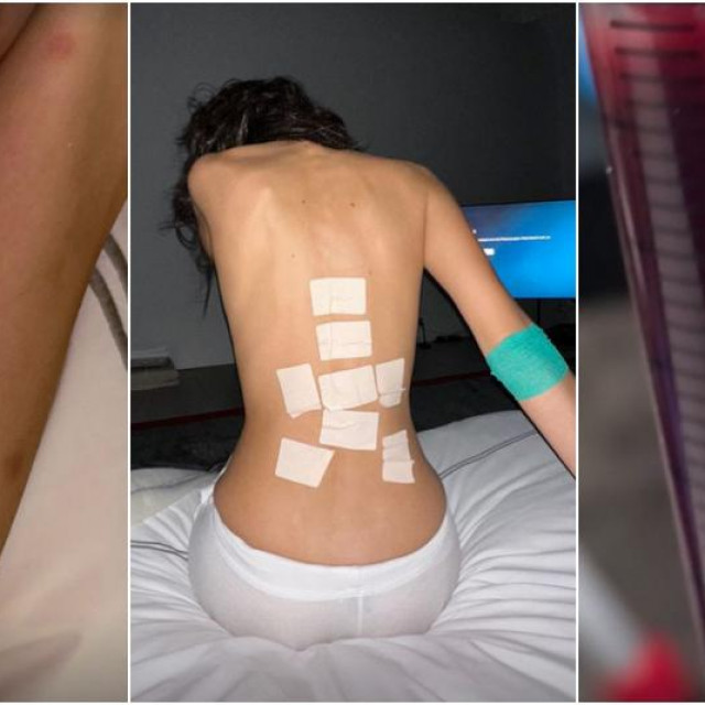 Uznemirujuće fotografije s Instagrama