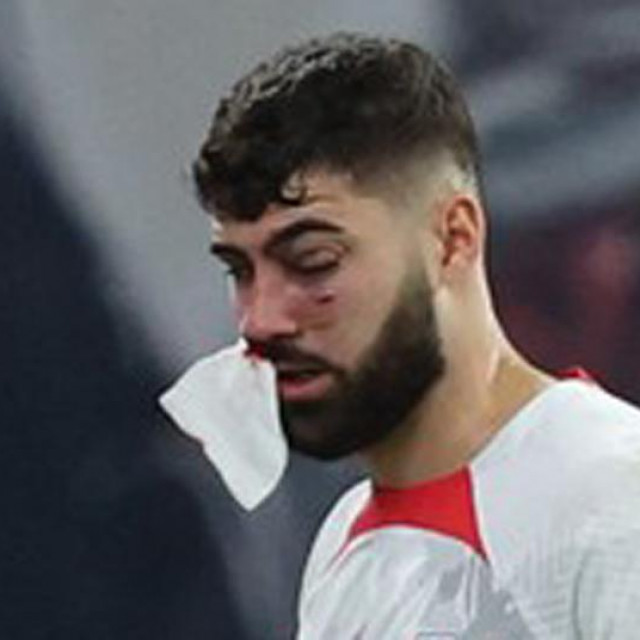 Joško Gvardiol slomljenog nosa napušta teren