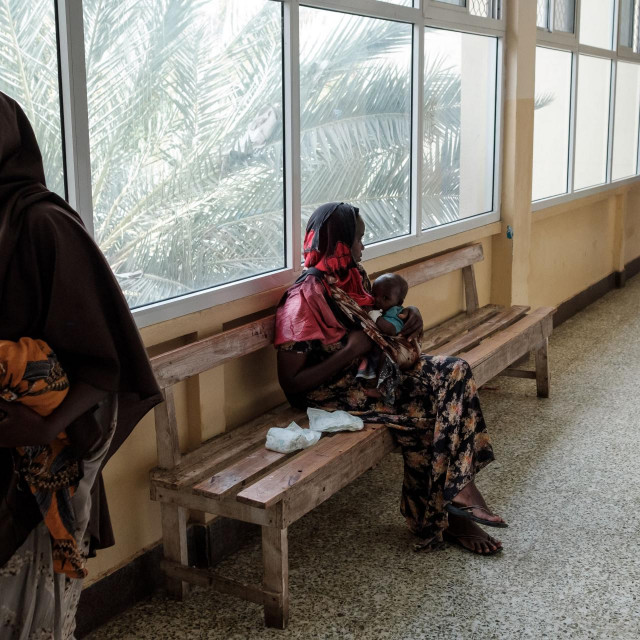 Najteži oblici pothranjenosti zabilježeni su u Somaliji