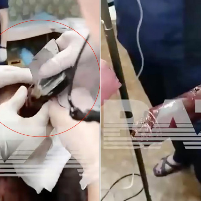 Minobacačka granata