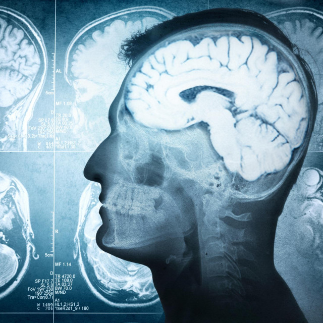 Conceptual image of a man from side profile showing brain and brain activity. Retro stale.