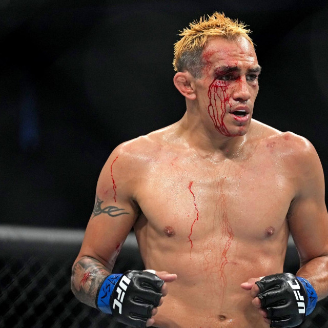 Tony Ferguson