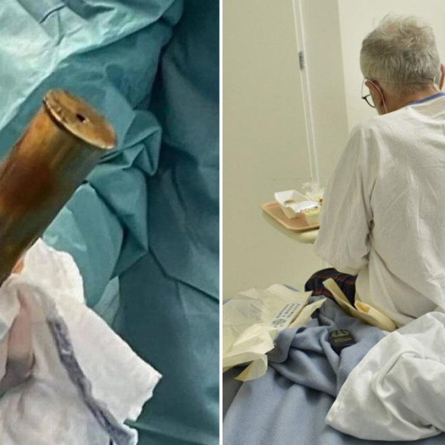 Izvađena granata/Ilustracija