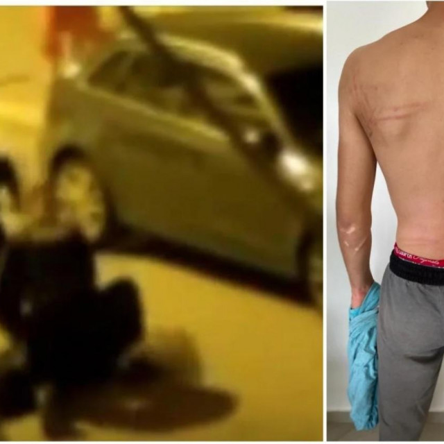 Pretučeni mladić u Splitu