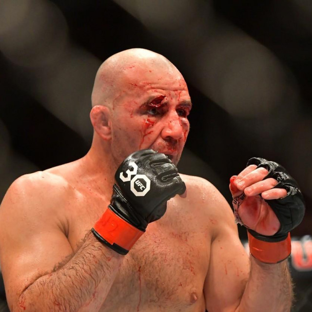 Glover Teixeira
