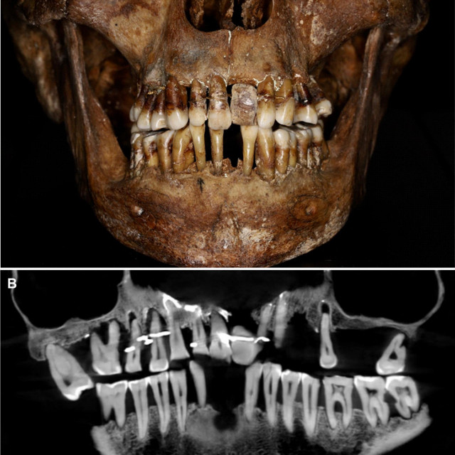 Lubanja francuske aristokratkinje Anne d‘Alegre