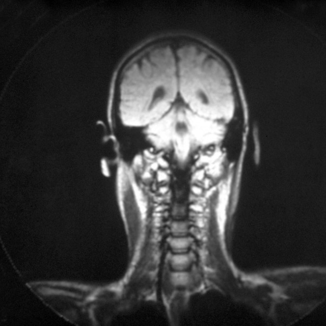 Ilustrativna fotografija