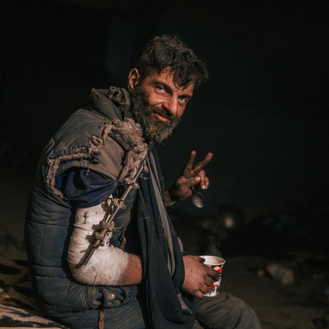 Ranjeni ukrajinski vojnik iz Azovstala