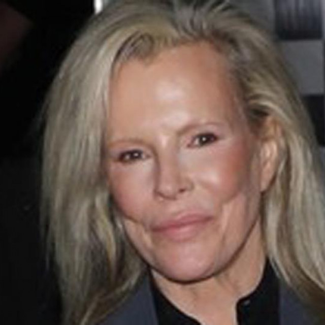 Kim Basinger