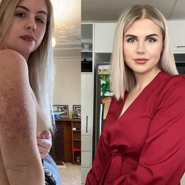 Žena podijelila javno reakciju na lijek