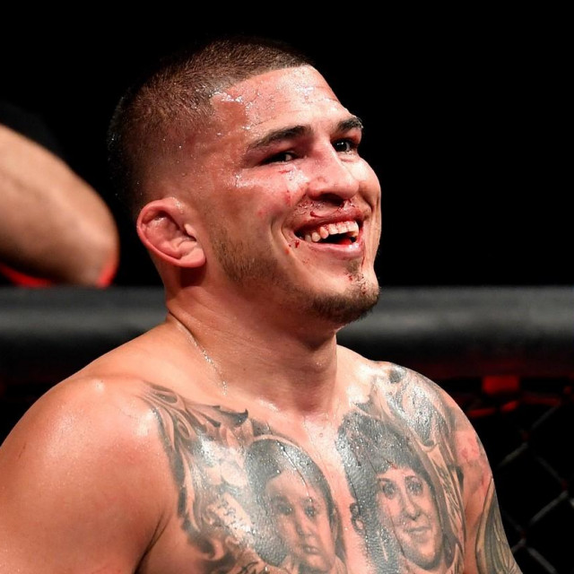 Anthony Pettis